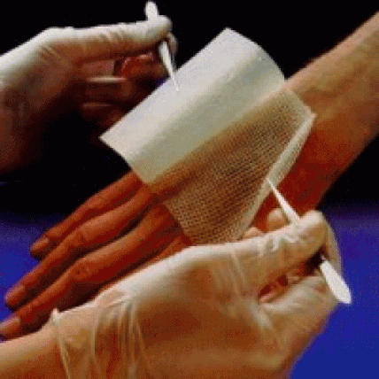 Chlorohexadine Dressing Gauze-1