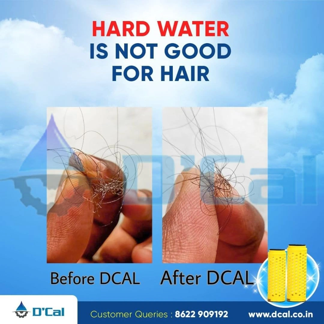 D'Cal - Hard Water Softener | For Complete House | Protects Taps, Pipes &amp; Bathrooms | Reduces Dry Skin &amp; Hair Loss | Easy to Use | 1 year Life | No Maintenance | Food Grade-2