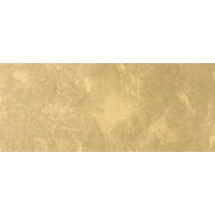 Rich Gold Metallic Veneer-3