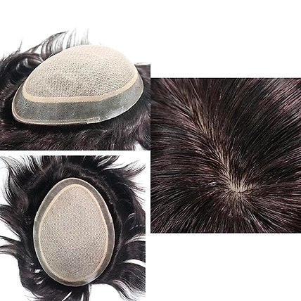 Mirage Skin Scalp Based Male Hair System-2