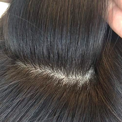 Mirage Skin Scalp Based Male Hair System-3