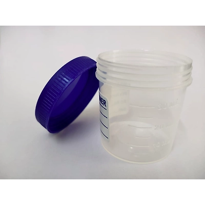 Plastic Urine Specimen Container – 30ml, Flip-Top, Tamper-Proof Cap