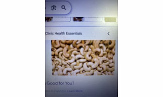 Fresh Cashew Nuts