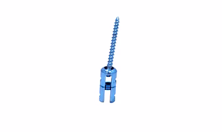 Lateral Mass Reduction Screw