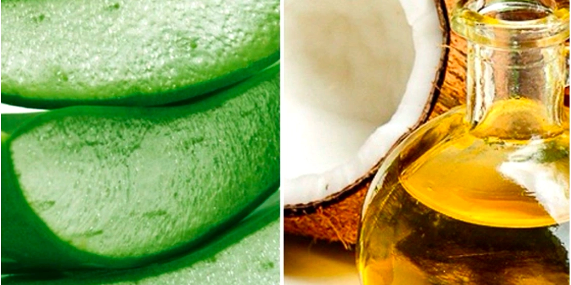 LOOKING FOR A REMEDY FOR STRETCH MARKS; TRY OUT KERALA NATURALS COCONUT OIL AND ALOE VERA GEL