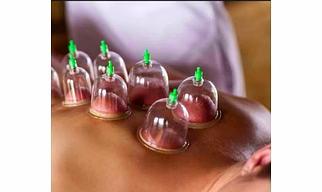 Dry Cupping