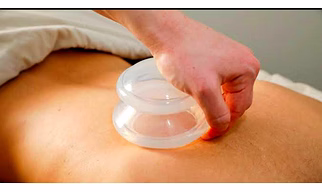 Oil Cupping Upper Back