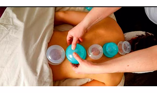 Oil Cupping Full Body