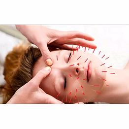 cosmetics acupuncture