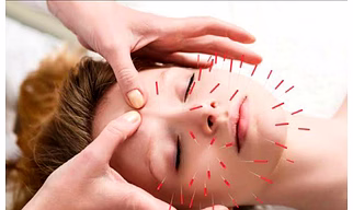 Cosmetics Acupuncture