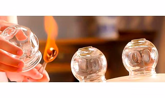 Fire Cupping