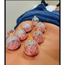 wetting cupping