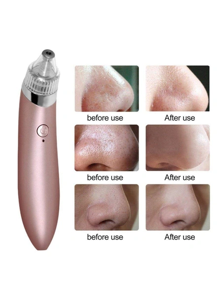 Rechargeable Blackhead and Whitehead Remover Machine for Face Acne Pimple Pore Cleaner Vacuum Suction Facial G5.-3