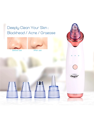 Microdermabrasion Blackhead Remover Vacuum Suction Face Pimple Acne Comedone Extractor Facial Pores Cleaner Skin Care Tools 38-32970174364
