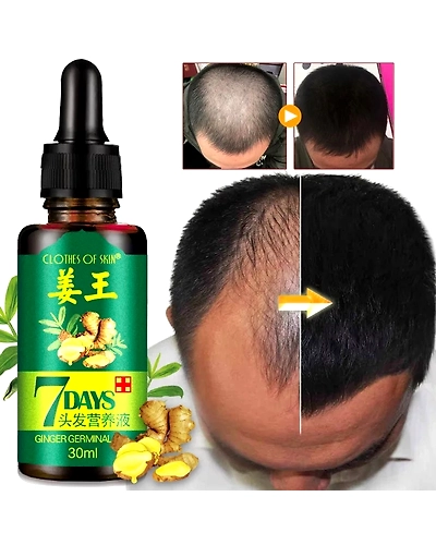 Natural Repair Fast Hair Growth Fluid Hair Loss Treatment Healthy Hair Growth Liquid Biotin Essence-33022310056