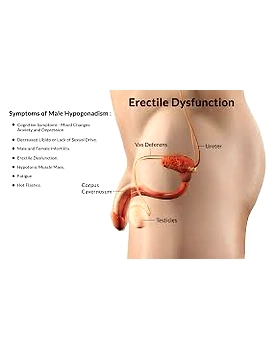 Erectile Dysfunction