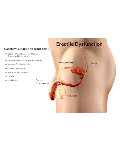 Erectile Dysfunction-6474658