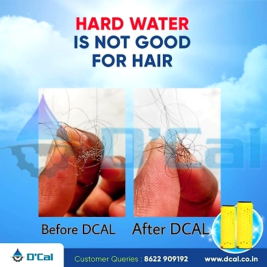 D'Cal - Hard Water Softener | For Complete House | Protects Taps, Pipes &amp; Bathrooms | Reduces Dry Skin &amp; Hair Loss | Easy to Use | 1 year Life | No Maintenance | Food Grade-3