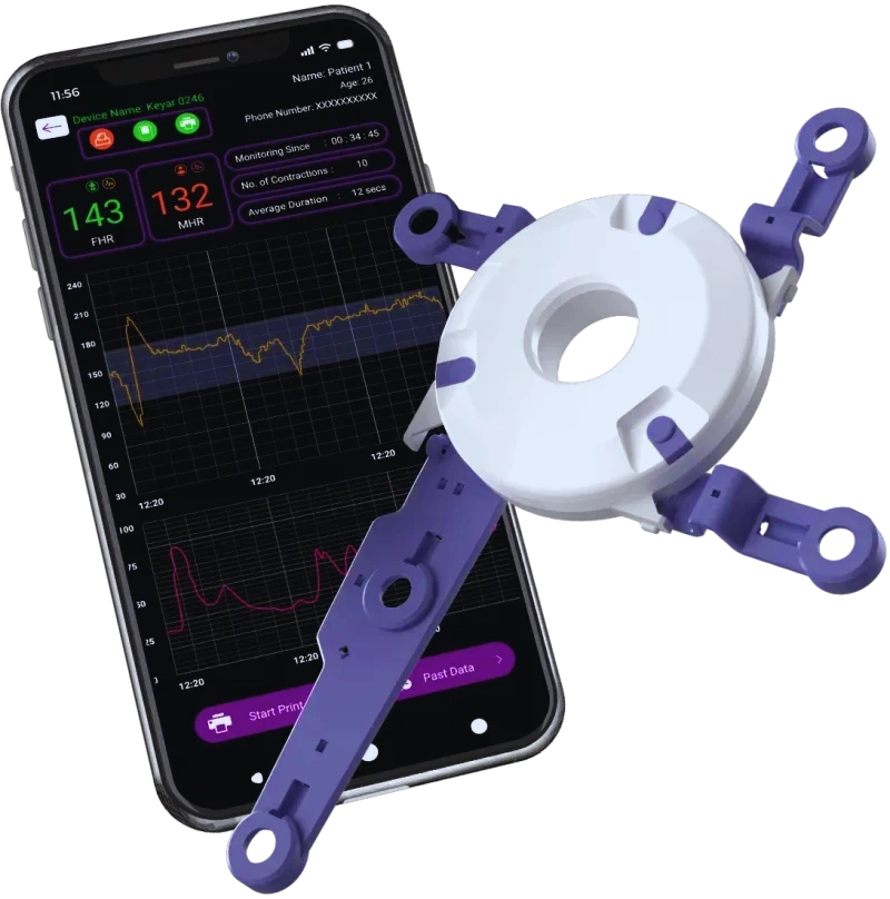 Fetal ECG-HH-002