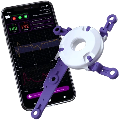 Fetal ECG-HH-002