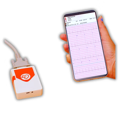 ECG Tracker-2