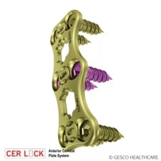 Anterior Cervical Plate System Spine implants