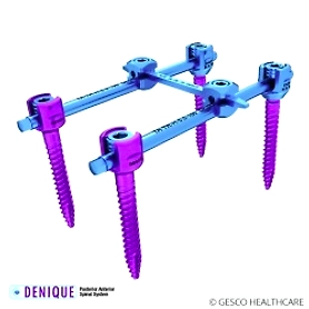 SPINE IMPLANTS NEURO IMPLANTS ORTHO IMPLANTS CMF GENERAL SURGICAL INSTRUMENTS