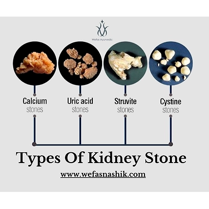 Ki-Stone Clear Powder (Kidney Stone Remover)-3
