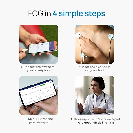 Spandan PRO pocket ECG with AI-12542708