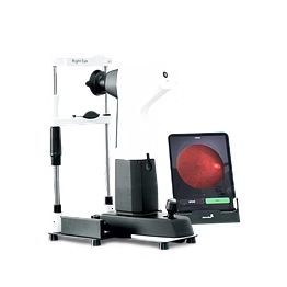 remidio widefield fundus camera - pristine 5.0