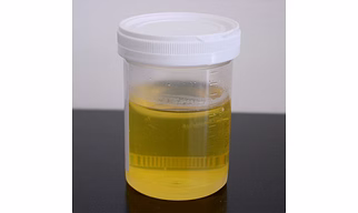 DONKEY URINE