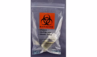 Biohazard specimen bag