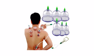 Hijama Cupping Cup